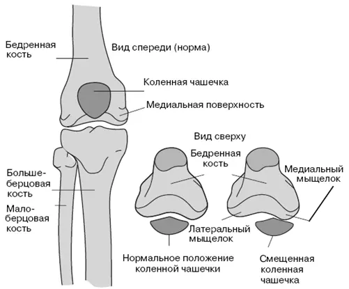 Рис 113 Коленная чашечка и медиальная поверхность Как и при всех других - фото 16