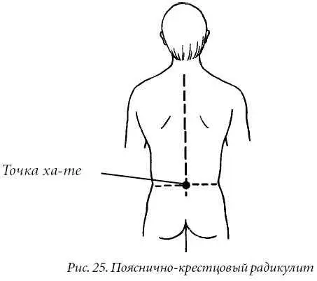 Шейный радикулит прострел Гармонизирующая точка фаиюань рис 26 Метод - фото 25