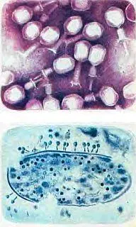 Рис 3 Вирусы вверху бактериофаги Т4 у которых видны сократившиеся чехлы - фото 5