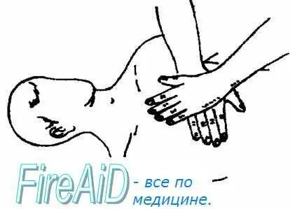 положить руку поверх руки переплести пальцы оттянув их от грудной клетки - фото 7