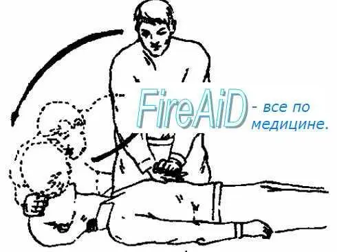 Продолжать до тех пор пока а вас ктото не сменит б не придет скорая - фото 11