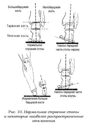 Но даже при нормальном строении стопы возникают существенные различия в - фото 11