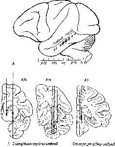 Рис XVII7 А боковая проекция мозга с указанием участков стимуляции - фото 191