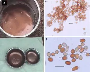Окрашенная дождевая вода и найденные в ней частицы Длина линии 10 мкм Но - фото 34