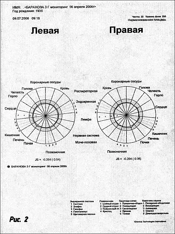 Правая и левая диафрагмы практически идентичны сбалансированы что говорит об - фото 3