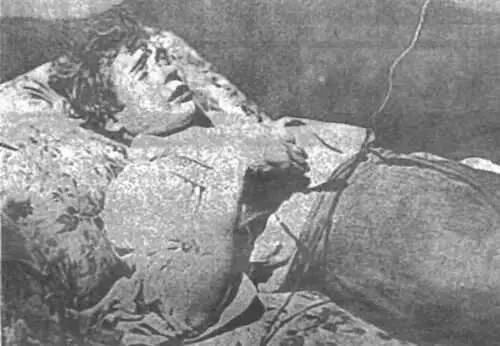 Сергей Есенин на смертном одре Ленинград гостиница Англетер 28 декабря 1925 - фото 36