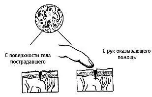 ШокПри любых тяжелых травмах ранениях действует совокупность факторов - фото 28