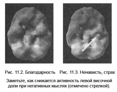 Отрицательное мышление плохо сказывается на мозге А признательность буквально - фото 44