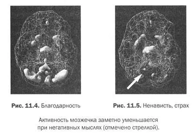 Отрицательное мышление плохо сказывается на мозге А признательность буквально - фото 45