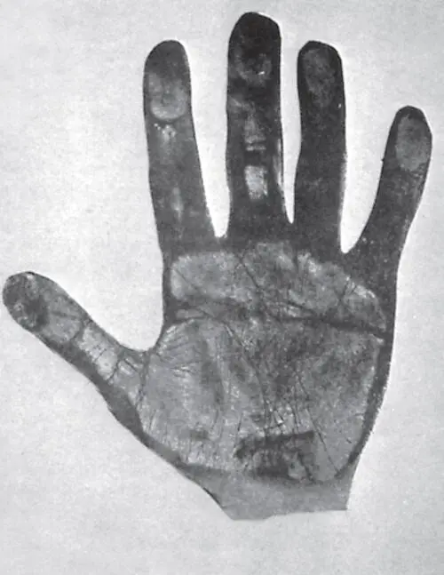 Фото 20 Кисть правой руки доктора Майера чикагского заключенного - фото 70