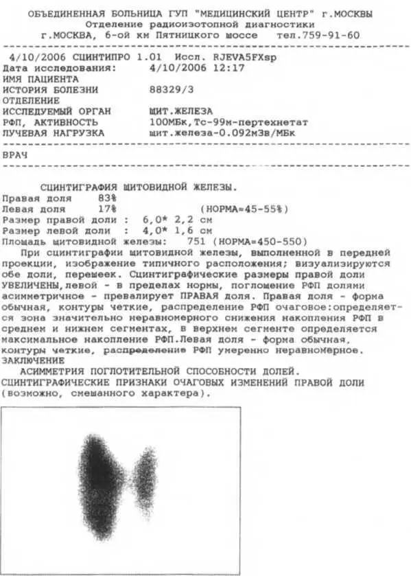 Рисунок 10 Копия описания и заключения о проведенной сцинтиграфии Поэтому - фото 20