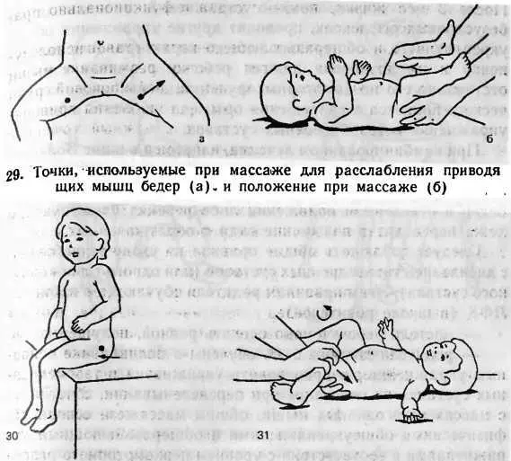 30 Проекция входа головки бедра в вертлужную впадину 31 Ротация бдра внутрь - фото 14