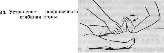 2 И п то же Для устранения поворота стопы вокруг своей продольной оси - фото 22