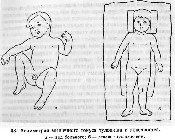 четании е массажем на расслабление спастически сокращенных мышц Массаж - фото 25