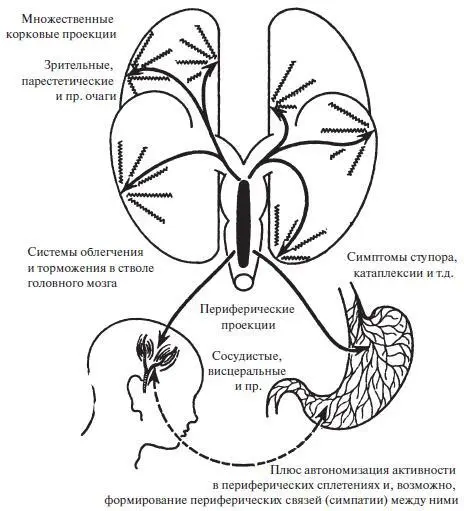 Рис 7 Схема гипотетического мигренозного процесса Схематическое - фото 18