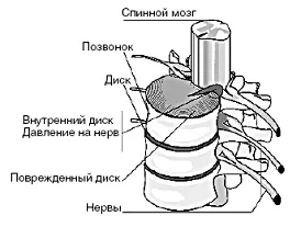 Диск белковое кольцо внутри которого расположено студенистое упругое тело - фото 92
