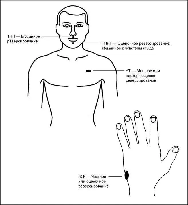 Рис 3Точки акупунктуры для воздействия на различные типы реверсирования После - фото 4