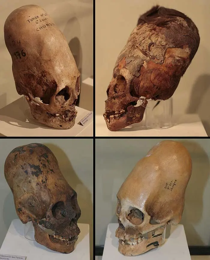 Рис 28ц Первое что бросается в глаза это аномальная форма и размеры не - фото 31