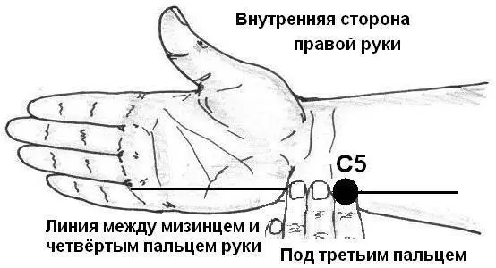 Рисунок 35 МС610 внутренняя сторона левой руки греть до 2 минут - фото 27