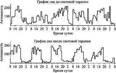 Световая терапия у пациентов с болезнью Альцгеймеранарушенный ритм - фото 17