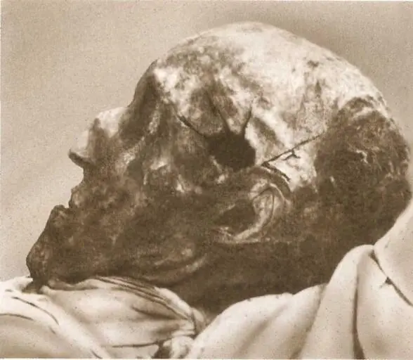 Голова Карла XII Снимок сделан при эксгумации тела короля в 1917 г Й Р - фото 80