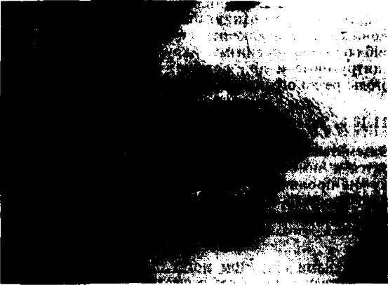 Рис 1157 Атопический хейлит На инфильтрированной красной кайме губ мелкие - фото 245
