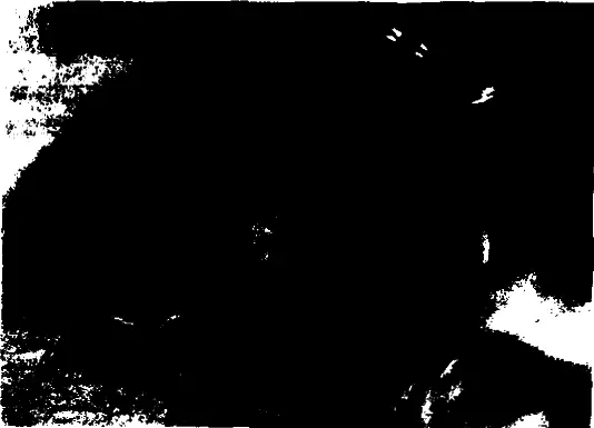 Рис 1159 Болезнь Боуэна Участок гиперкератоза с мелкобугристой поверхностью - фото 247
