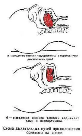 Стандартный комплекс неотложной ИТ включет 3 компонента 1 восстановление прох - фото 1
