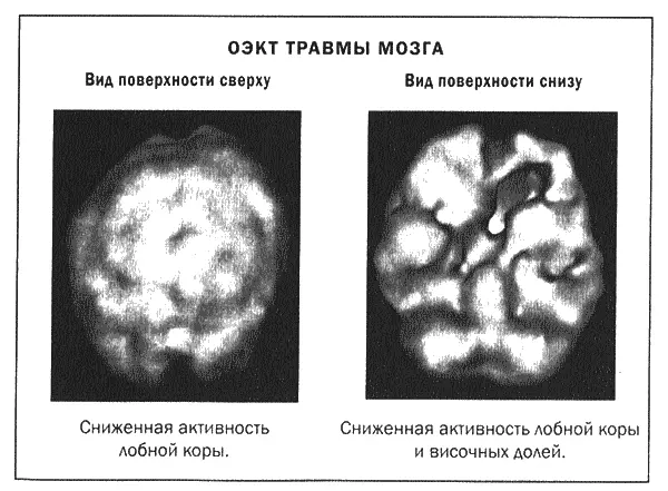 Височные доли и лимбическая система это удивительная часть нашего - фото 19