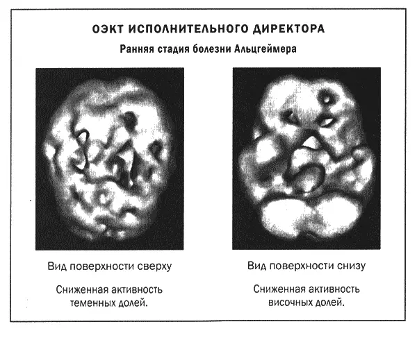 Проблемы с памятью приводят к тому что лидеры забывают прошлое и не учатся на - фото 25