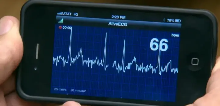 Приложение AliveCor демонстрирует ЭКГ на экране смартфона кадр из деморолика - фото 63