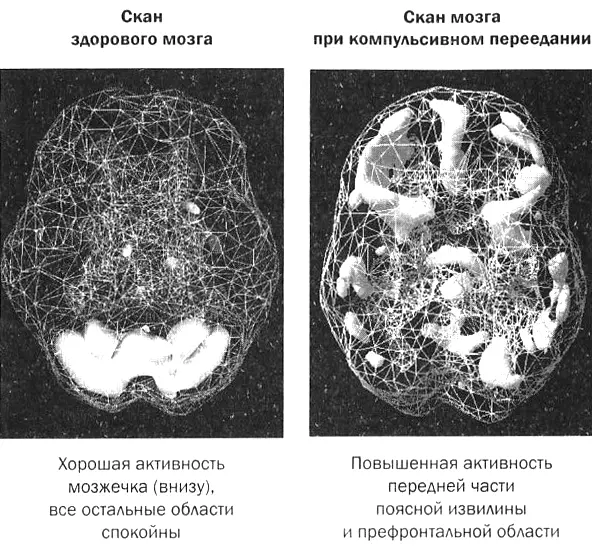 Эти томограммы выявляют зоны увеличенной активности Серый цвет указывает на - фото 34