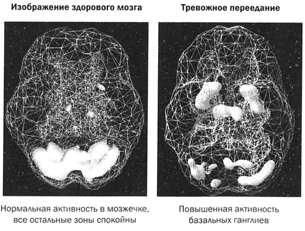 Что ухудшает состояние при тревожном переедании Определенные вещества и типы - фото 39