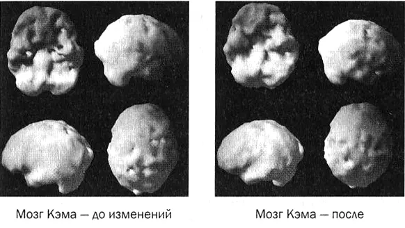 В качестве части нашего исследования мы назначили Кэму программу реабилитации - фото 59