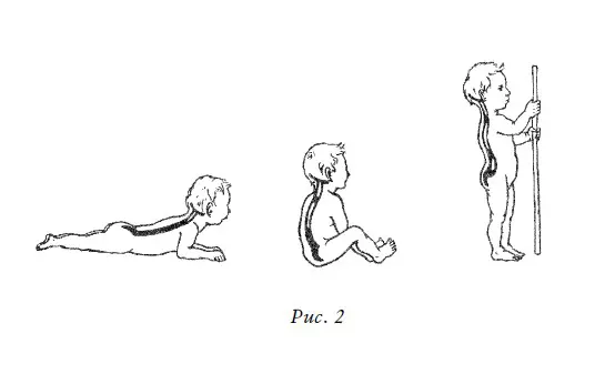 Затем когда ребенок начинает сидеть усиливается грудной кифоз изгиб кзади - фото 2