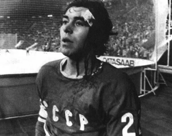 Травмированный Вячеслав Анисин Чемпионат мира в ФРГ 1975 г Нами были - фото 78