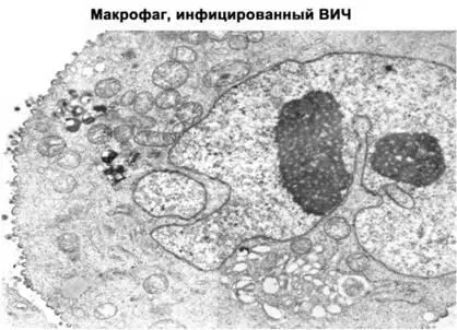 Рис 10 На электронномикроскопической фотографии макрофага инфицированного - фото 16