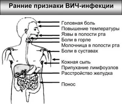 Рис 22 При ВИЧинфекции самые ранние признаки более или менее одинаковы - фото 36