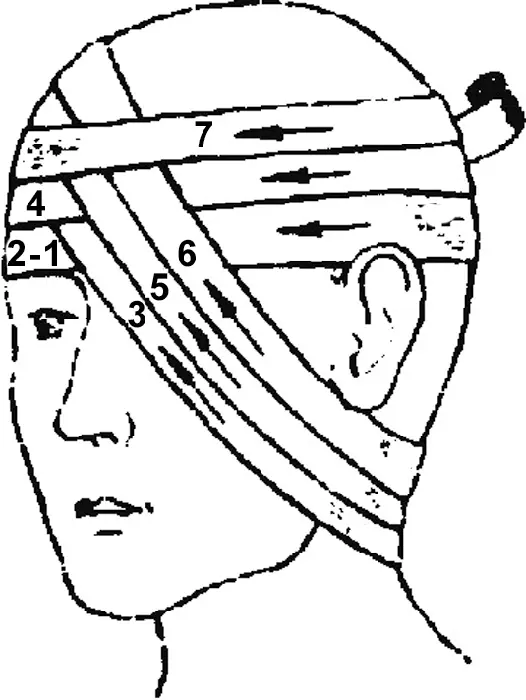 Рис 210 Повязка на левый глаз и оба глаза 49 При ранениях ухабинтование - фото 23