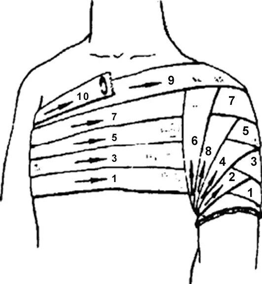 Рис 212 213 Колосовидная повязка на плечевой сустав 52 На грудную - фото 25