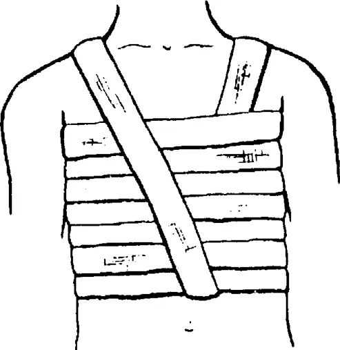 Рис 214 Повязка на грудную клетку 53 На голеностопный суставнакладывается - фото 26