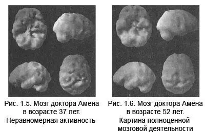 Десять принципов изменения мозга и тела 1 Ваш мозг участвует во всем что вы - фото 6