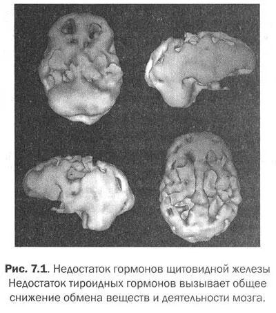 Вы наслышаны о предменструальном синдроме ПМС У меня пять сестер и три - фото 25