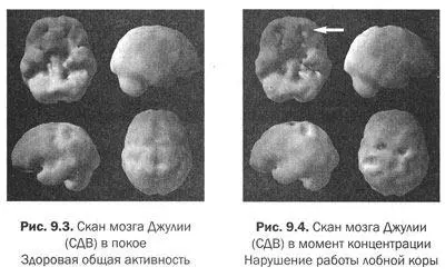 Похожий снимок был и у Джулии в момент концентрации у нее снижалась активность - фото 37