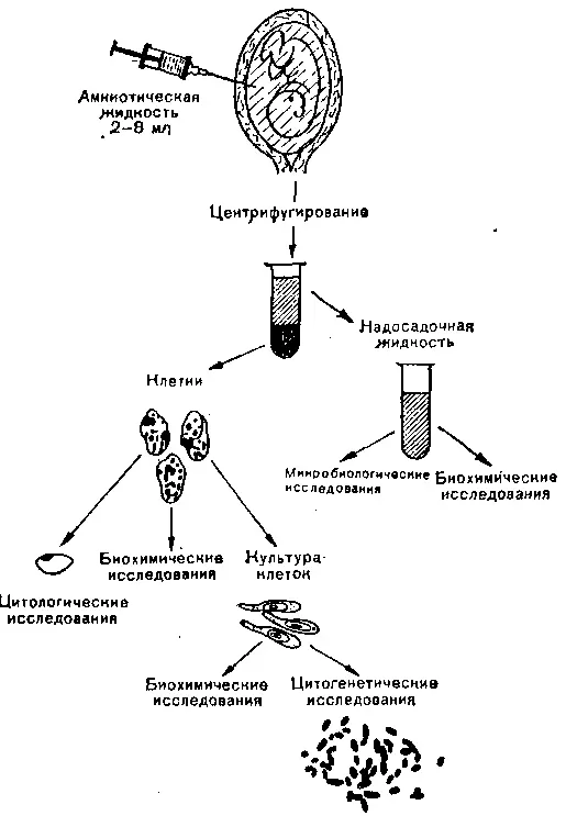 Рис 24 Схема проведения амниоцентеза Из вышесказанного ясно что родители - фото 27