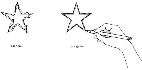 87 Несмотря на очевидную потерю памяти Г М сохранил способность обучаться - фото 37