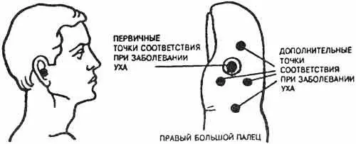 Рис 119 Точки соответствия при заболеваниях среднего уха на боковых - фото 130