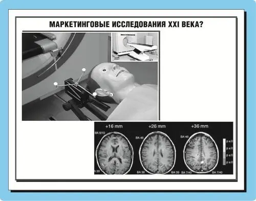 Рис 533 Компьютерная томография мозга новый инструмент маркетинговых - фото 72