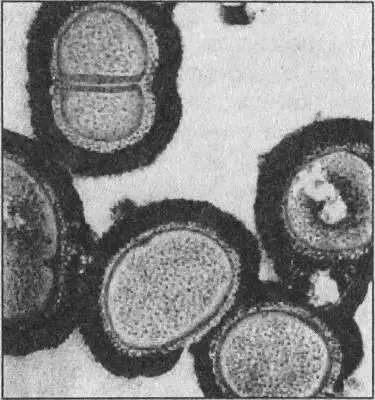 Бактерия Staphylococcus aureus источник госпитальных инфекций Подобные - фото 121