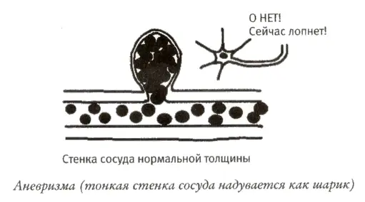 Артериовенозная мальформация АВМ одна из редких разновидностей - фото 8